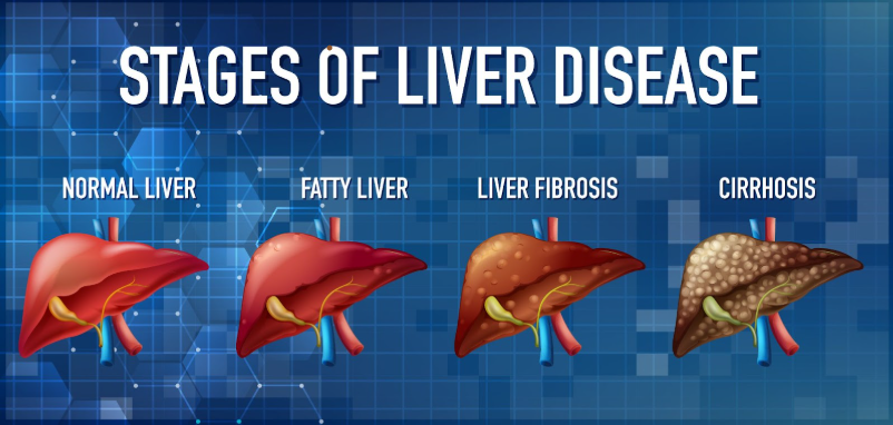fatty-liver-and-diabetes-a-dangerous-combination-big-0