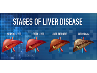 fatty-liver-and-diabetes-a-dangerous-combination-small-0