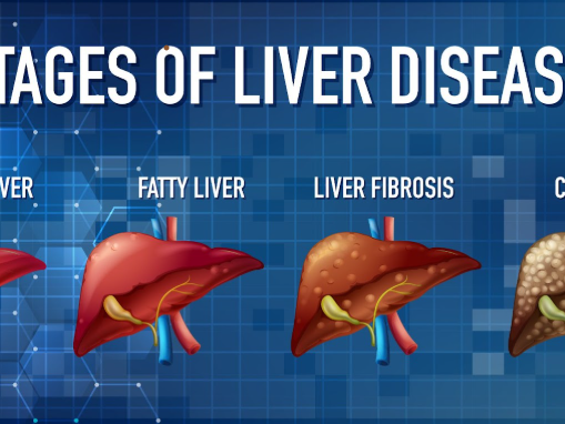 fatty-liver-and-diabetes-a-dangerous-combination