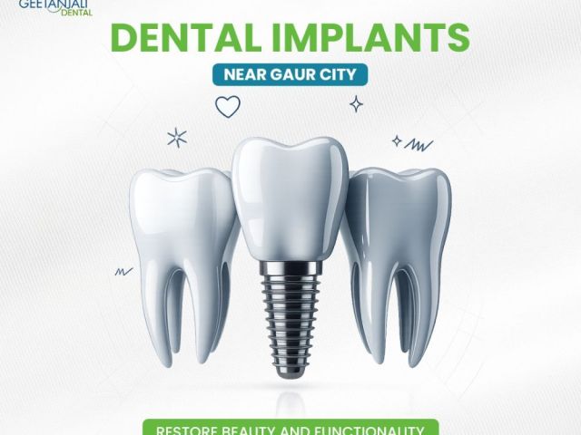 dental-implant-doctor-in-gaur-city