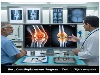 best-knee-replacement-surgeon-in-delhi-for-faster-recovery-small-0