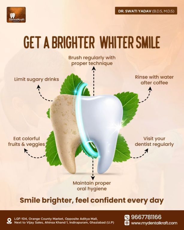 safe-teeth-whitening-treatment-in-indirapuram-for-bright-smiles-big-0