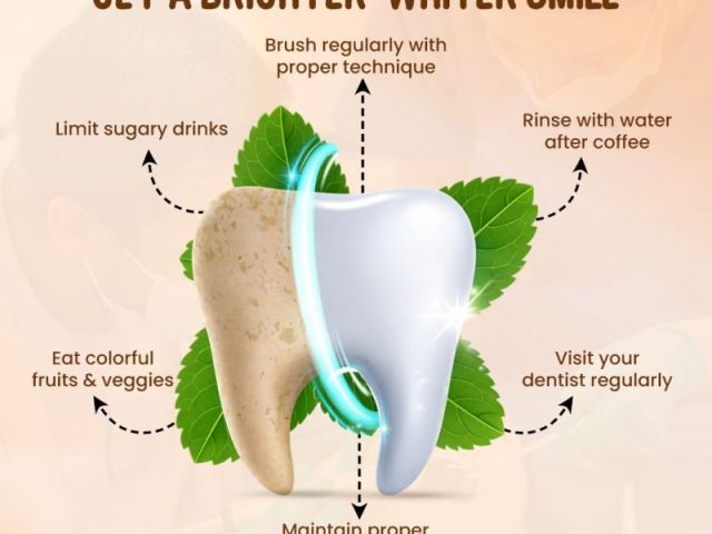 safe-teeth-whitening-treatment-in-indirapuram-for-bright-smiles