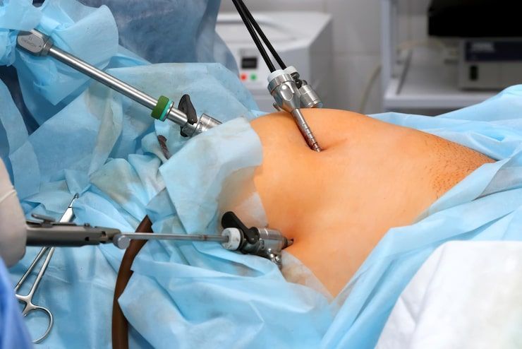 best-laparoscopic-surgery-hospital-in-gandhinagar-big-0