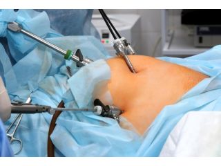 best-laparoscopic-surgery-hospital-in-gandhinagar-small-0