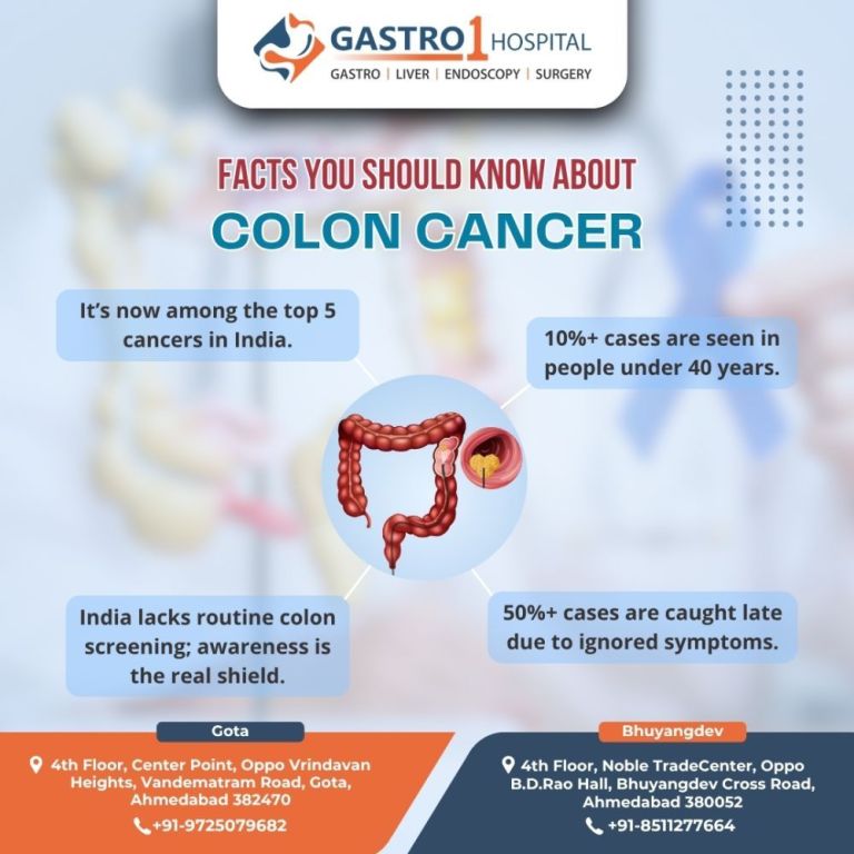 trusted-center-for-best-colon-cancer-treatment-in-ahmedabad-big-0