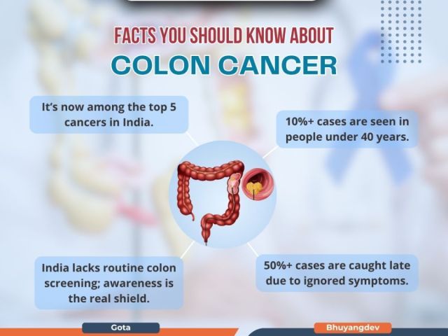 trusted-center-for-best-colon-cancer-treatment-in-ahmedabad