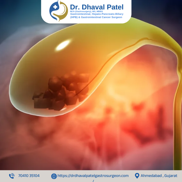 gallbladder-cancer-surgery-in-ahmedabad-with-latest-technology-big-0