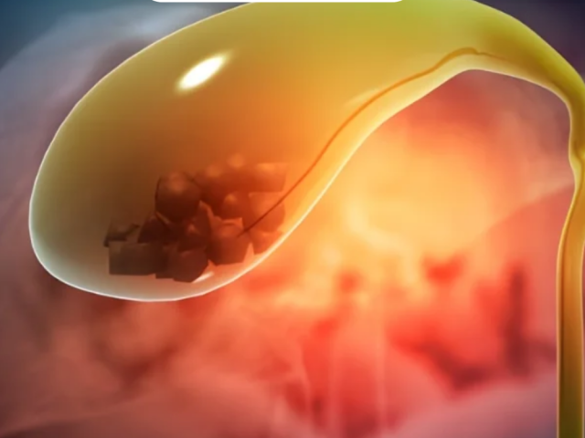 gallbladder-cancer-surgery-in-ahmedabad-with-latest-technology