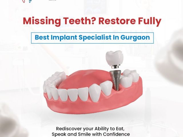 best-implant-specialist-in-gurgaon-for-trusted-dental-solutions