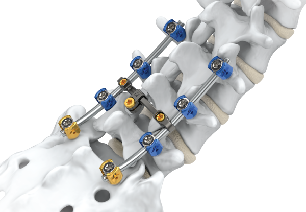 advanced-spine-fixation-surgeon-in-kolkata-big-0