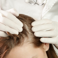 best-hair-treatment-clinic-in-chandigarh-cosmeticare-big-0