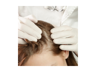 best-hair-treatment-clinic-in-chandigarh-cosmeticare-small-0