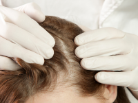 best-hair-treatment-clinic-in-chandigarh-cosmeticare