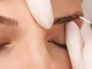 transform-your-look-with-customized-eyebrow-restoration-hyderabad