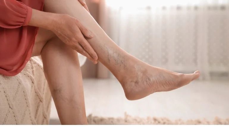 minimally-invasive-solutions-for-deep-vein-thrombosis-big-0