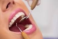 best-dentist-in-chetla-for-healthy-smiles-big-0