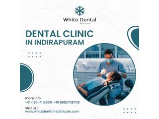best-dental-clinic-in-indirapuram-small-0