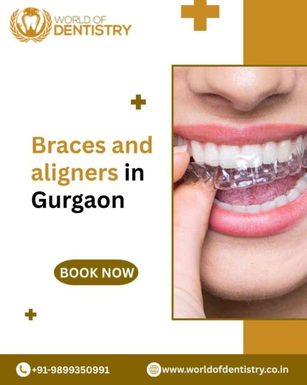 braces-and-aligners-in-gurgaon-big-0