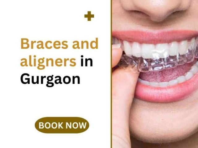 braces-and-aligners-in-gurgaon
