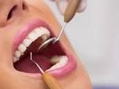 best-dental-clinic-in-chetla-for-complete-smile-care