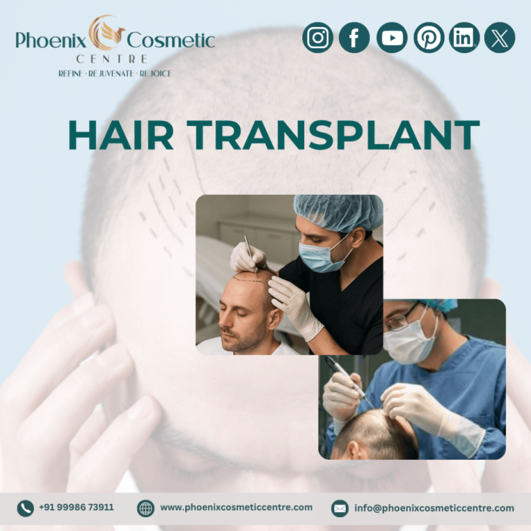 effective-hair-transplant-surgery-in-ahmedabad-big-0