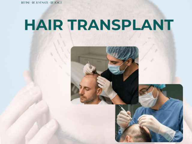 effective-hair-transplant-surgery-in-ahmedabad