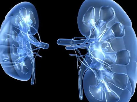 acute-kidney-injury-treatment-expert-aki-care