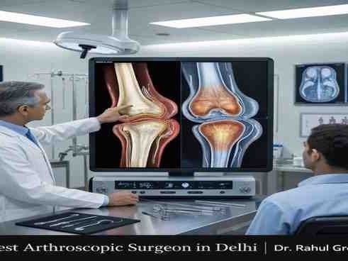best-arthroscopic-surgeon-in-delhi-for-advanced-joint-care