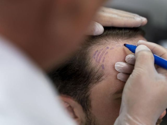 you-can-stop-hair-loss-50000-trusted-us-for-their-hair-concern