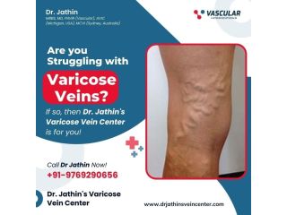 modern-vein-treatment-for-healthy-circulation-comfort-small-0