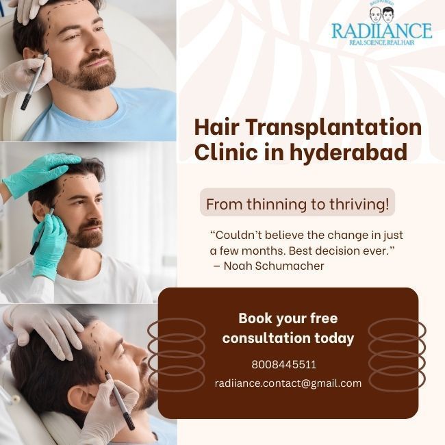 best-hair-transplant-in-hyd-big-0
