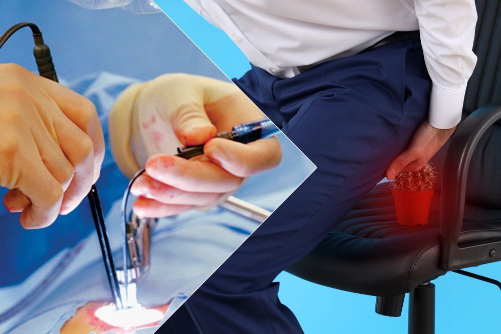pilonidal-sinus-treatment-in-dadar-west-big-0