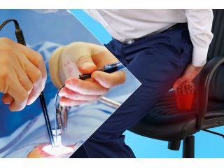 pilonidal-sinus-treatment-in-dadar-west-small-0
