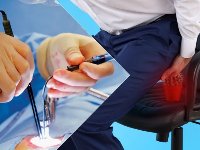 pilonidal-sinus-treatment-in-dadar-west