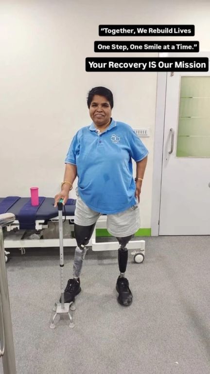 best-artificial-leg-in-hyderabad-carevale-prosthetics-big-1