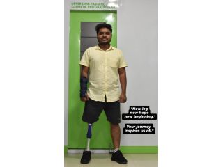 best-artificial-leg-in-hyderabad-carevale-prosthetics-small-3