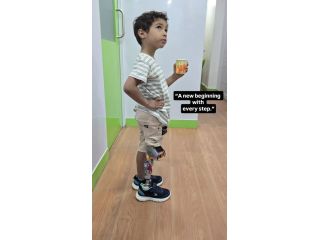 best-artificial-leg-in-hyderabad-carevale-prosthetics-small-2