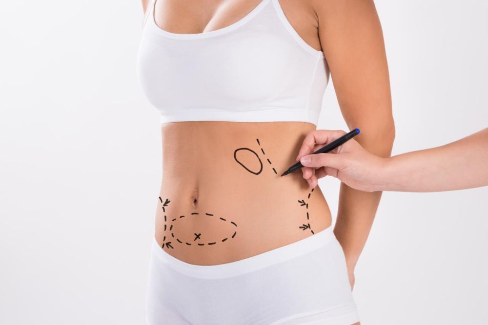best-tummy-tuck-surgery-in-delhi-for-a-flat-firm-abdomen-big-0