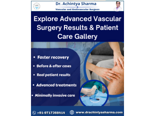 vascular-surgery-results-patient-care-gallery-small-0