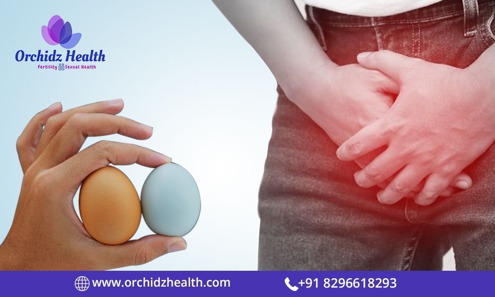 best-varicocele-treatment-in-bangalore-for-effective-relief-big-0