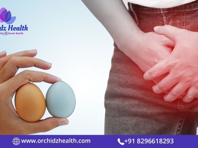 best-varicocele-treatment-in-bangalore-for-effective-relief