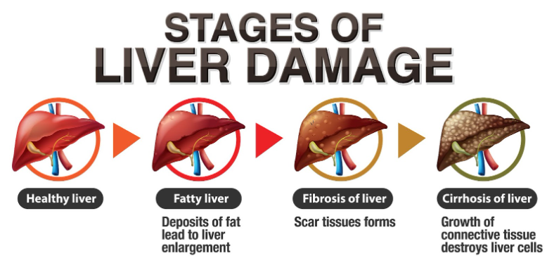 liver-health-myths-that-delay-proper-treatment-big-0
