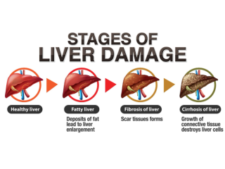 liver-health-myths-that-delay-proper-treatment-small-0
