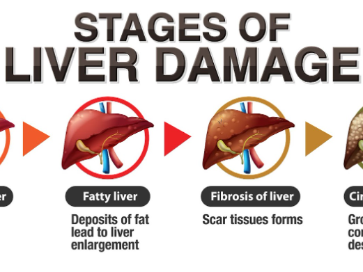 liver-health-myths-that-delay-proper-treatment