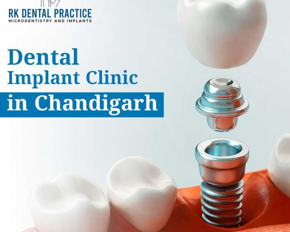 best-dental-implant-clinic-in-chandigarh