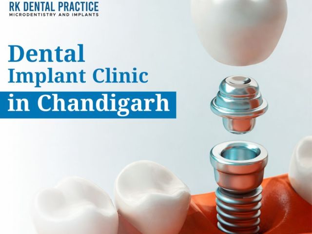 best-dental-implant-clinic-in-chandigarh