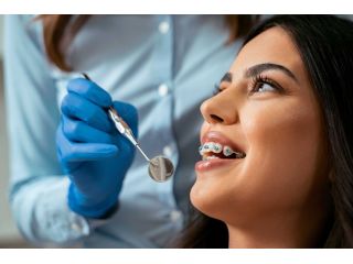 orthodontist-in-pune-best-braces-dental-alignment-solutions-small-0