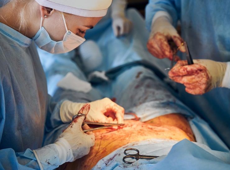trusted-laparoscopy-surgery-in-gandhinagar-big-0
