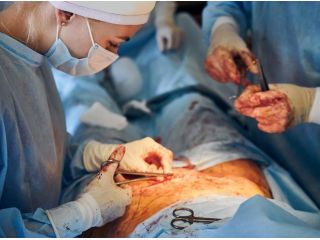 trusted-laparoscopy-surgery-in-gandhinagar-small-0
